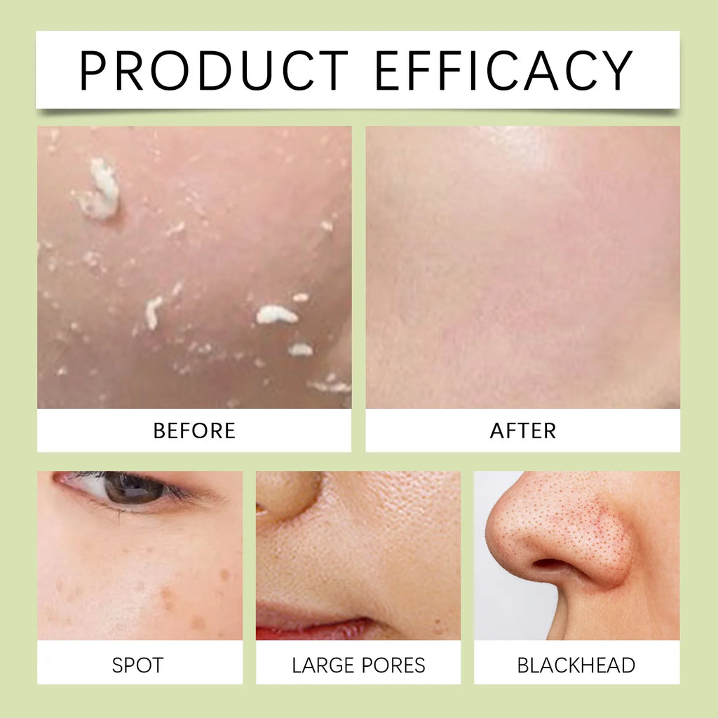 Green Tea Facial Scrub: Cleanses Pores Moisturizes Gently Exfoliates Enhances Skin Radiance, And Deeply Nourishes Facial Skin